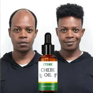 Essence Luban 30 ml, douce et hydratante, idéale pour les cheveux secs et irrités