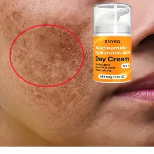 Crème de jour hydratante douce à la niacinamide avec FPS 15