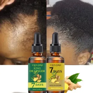 2 flacons de 30 ml d'huile essentielle de curcuma pour un soin capillaire de 7 jours